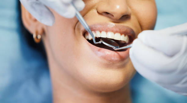 Best Emergency Dental Care for Broken or Chipped Teeth in Las Vegas, NV